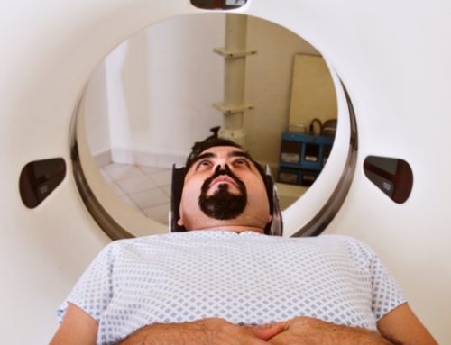 Myocarditis in Athletes After COVID-19 Infection